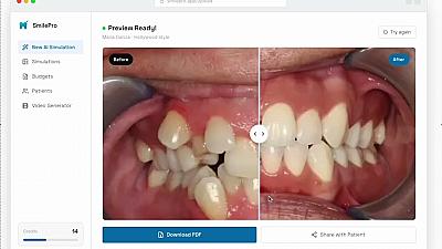 Скриншот SmilePro AI Simulation for Dentists