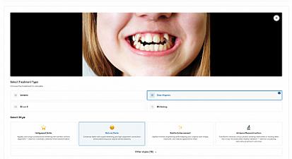 Скриншот SmilePro AI Simulation for Dentists