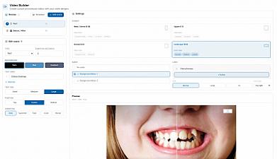 Скриншот SmilePro AI Simulation for Dentists
