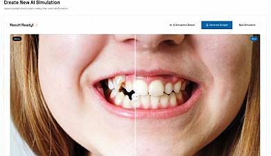 Скриншот SmilePro AI Simulation for Dentists